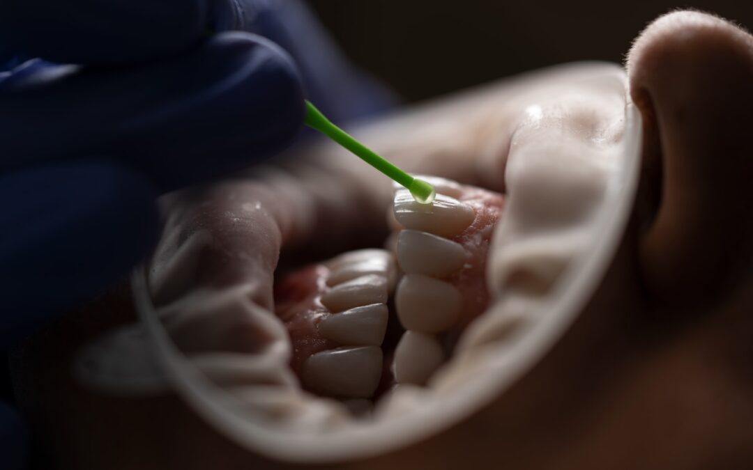 Стоматология. Эффективное фторирование зубов