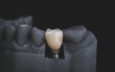 Стоматология. Когда необходимо удаление зуба?